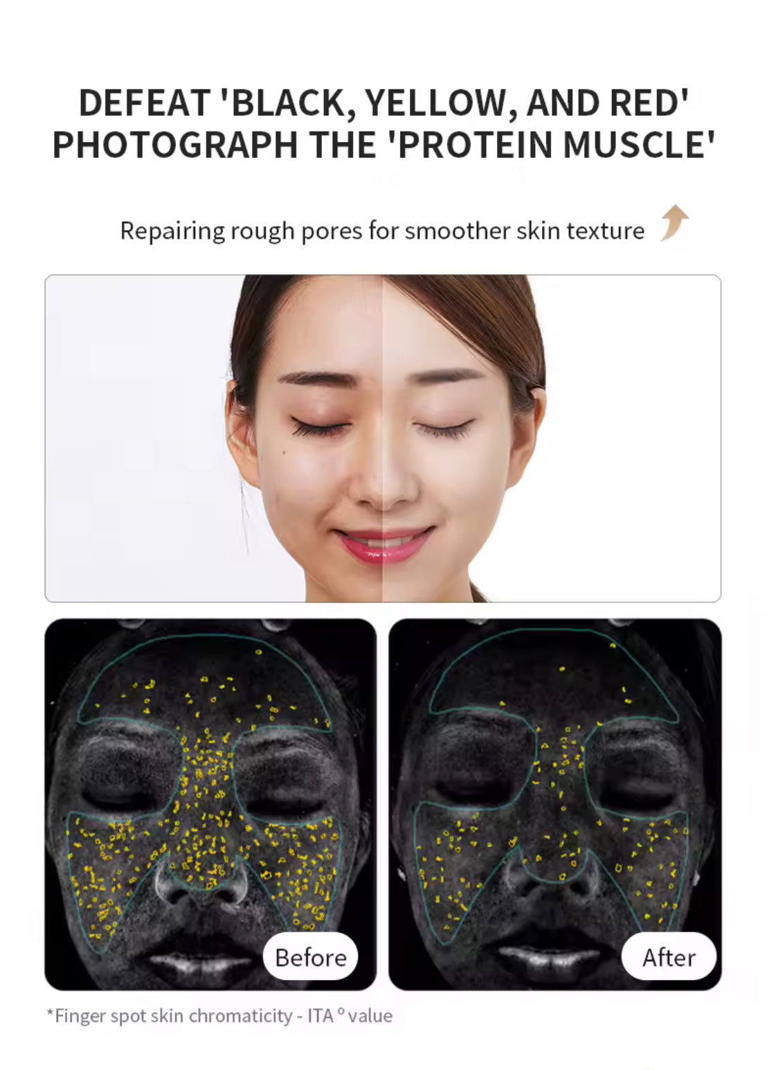 LED Face Mask Photon Therapy